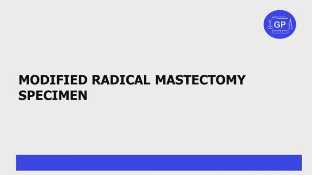 Radical mastectomy specimen