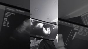 Малыш зевает в утробе