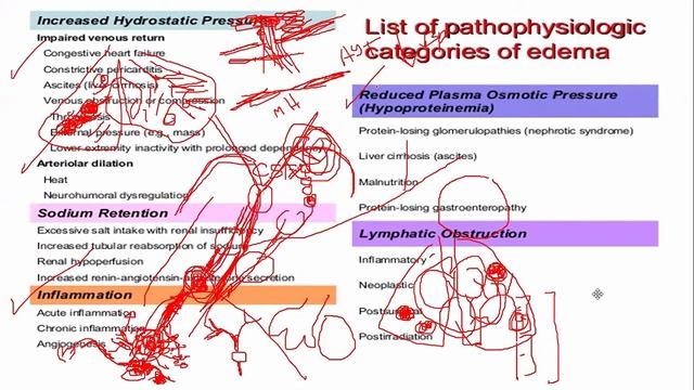 PHYSIO 20TH LECTURE EDEMA смотреть онлайн