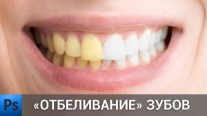 Как сделать отбеливание зубов в фотошопе | Teeth whitening in Photoshop