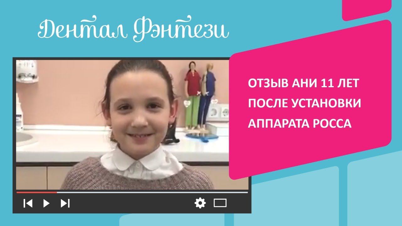 Отзыв Ани 11 лет после установки аппарата Росса