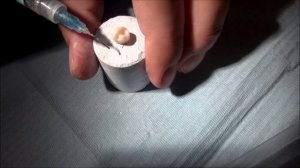 Герметизация фиссур в постоянных зубах у детей: демонстрация практического навыка для студентов.wmv