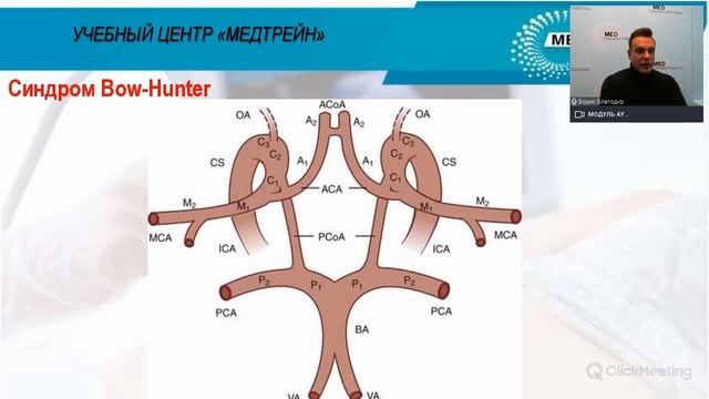 Медтрейн личный. Сегменты позвоночных артерий на кт. Сегменты позвоночной артерии кт. Гипоплазия позвоночной артерии кт. МЕДТРЕЙН вебинар УЗИ позвоночных артерий.