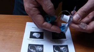 Голосовой клапан для использования с контуром ИВЛ