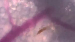 Комариный укус в увеличенном виде