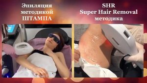 Отличие методик лазерной эпиляции SHR и штампа - Лазерная эпиляция, элос и фотоэпиляция в Краснодар