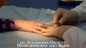 Удаление бородавки