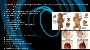 Trisomy 13(Patau's syndrome)-Symptoms and diagnosis.