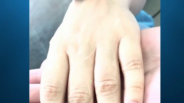 Рейтинг диодных лазеров. Топ-15 аппаратов для лазерной эпиляции