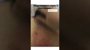 Отзыв Ирады Мивели о процедуре ГуаШа