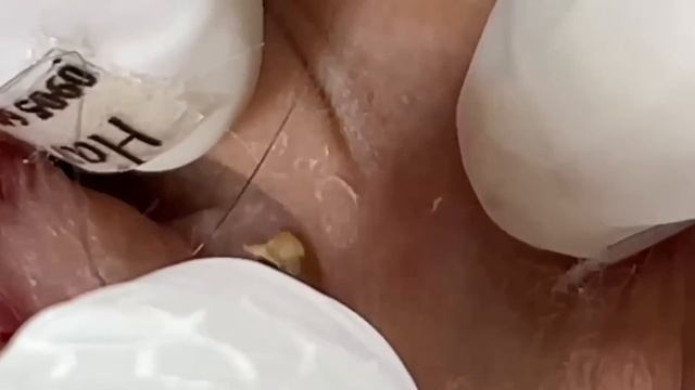 Enjoy Every Day With The Best Video Loan Nguyen Spa Official | 1421 смотреть онлайн