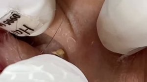 Enjoy Every Day With The Best Video Loan Nguyen Spa Official | 1421