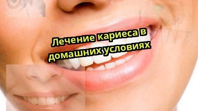 Лечение кариеса в домашних условиях