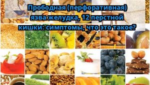 Прободная (перфоративная) язва желудка, 12 перстной кишки: симптомы, что это такое?