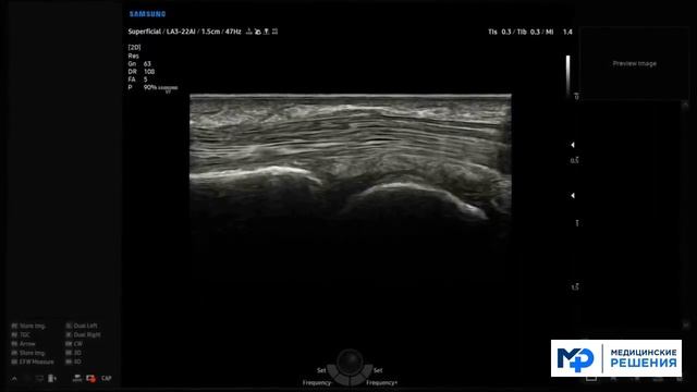 УЗИ-аппарат Samsung V7 смотреть онлайн