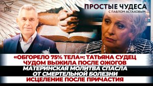 «ОБГОРЕЛО 75% ТЕЛА»: ТАТЬЯНА СУДЕЦ ЧУДОМ ВЫЖИЛА ПОСЛЕ ОЖОГОВ