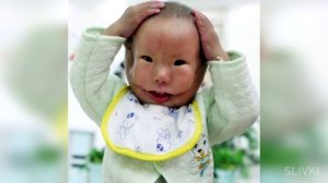 Топ5 ЛЮДЕЙ С ЛИШНИМИ ЧАСТЯМИ ТЕЛА