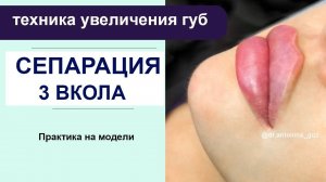 Сепарация губ / 3 вкола  - техника увеличения губ