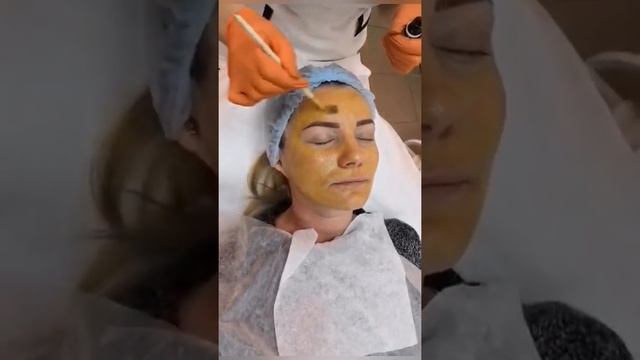 Жёлтый пилинг лица Пермь смотреть онлайн