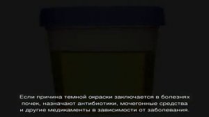 Темная моча у ребенка