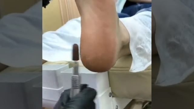 Аппаратный педикюр смотреть онлайн