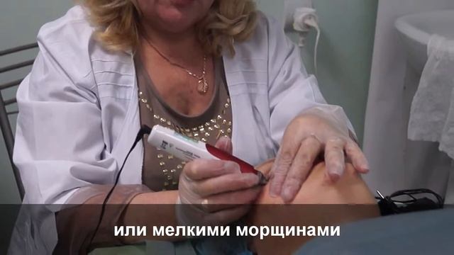 Геронт. Аппаратные процедуры. Удаление мелких морщин и рубцовой ткани смотреть онлайн