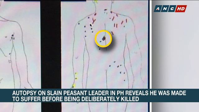 Autopsy on slain peasant leader in PH reveals he was made to suffer before being deliberately kille смотреть онлайн