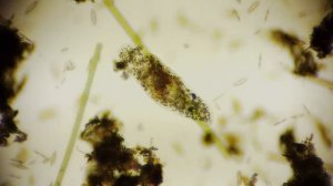 amoeba limax / Amöbe - microcosmos under a microscope - microorganisms in 1080p Full HD