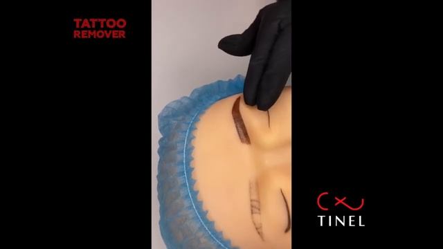 Ремувер TINEL удаление татуажа (часть 4)