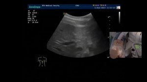 Ультразвуковая анатомия органов брюшной полости