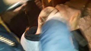Стрижка головы налысо машинкой \ Удаление полуострова