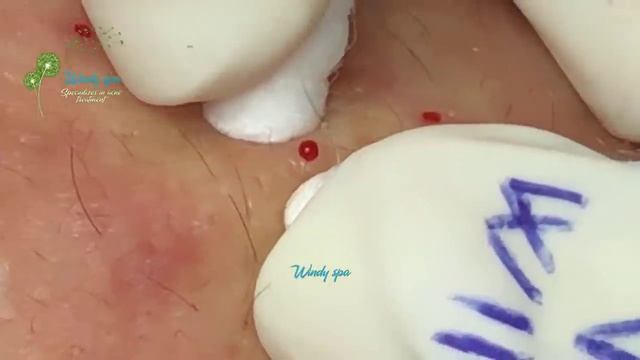 Make Your Day Relaxing with Windy Spa 6#118 смотреть онлайн