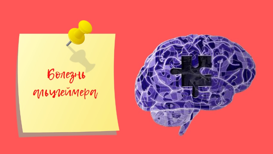 Болезнь альцгеймера | Как помочь больному