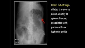 LearningRadiology 53 (100 Imaging Sings I)