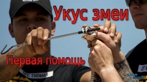 Укус змеи