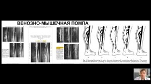 ЛЕКЦИЯ: РОЛЬ КЛАПАНА ПОДКОЛЕННОЙ ВЕНЫ И ПЕРФОРАНТНЫХ ВЕН