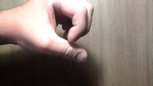 Разрыв сухожилия левой руки. 40 дней.