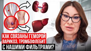 Как связаны геморой, варикоз, тромбофлебит с нашими фильтрами?
