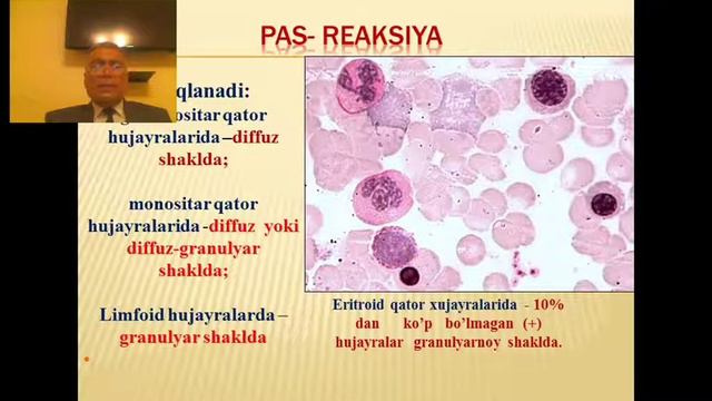 Гемобластозлар  Уткир ва сурункали лейкозлар