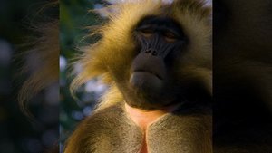 Голливудская улыбка