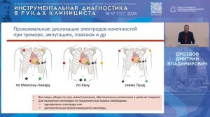 Методические рекомендации по регистрации ЭКГ покоя в 12 отведениях