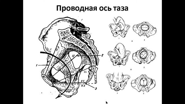 Акушерство, Роды (без первых 30 минут) смотреть онлайн