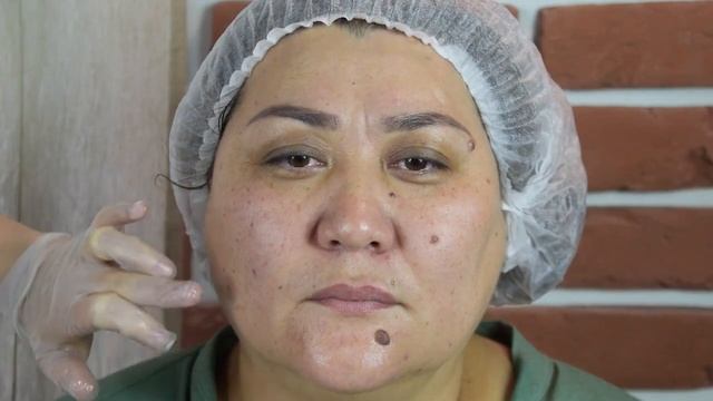 Отзыв косметолога о применении водородной косметички: использование в работе, эффект