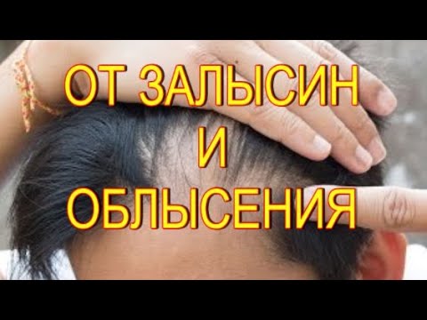 От Залысин и Сильном Облысении! Средство за 12 руб.