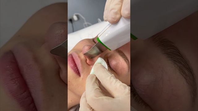 Ультразвуковая чистка лица