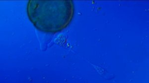 DIC Pzo. Амеба обыкновенная в процессе деления ( размножение) . Амеба раковинная .