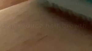 Can you epilate Pubic hair?