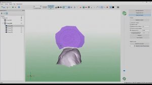 3D-сканирование в зоне 50 мм на сканерах Volume Tecnologies VT MINI и VT ATOM