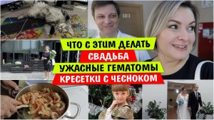 Что с ЭТИМ ДЕЛАТЬ / СВАДЬБА / Ужасные ГЕМАТОМЫ / Креветки с ЧЕСНОКОМ / Как приготовить Креветки