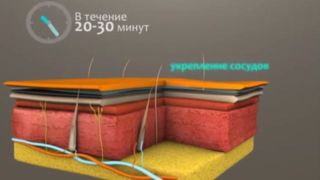 Грязевое обертывание